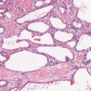 leber-gallenwege-pankreas